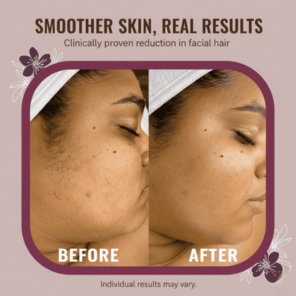Kivara EverSmooth™ Hair Reduction Serum
